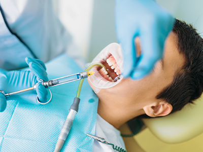 Why Men Hair Transplant